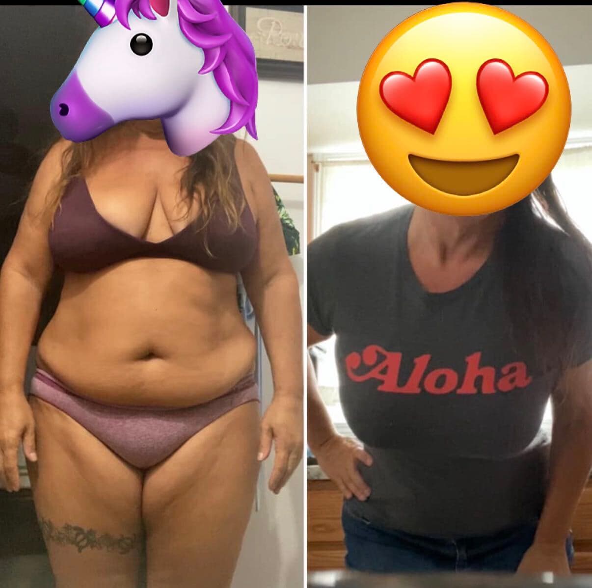 Front-view before and after with faces covered by emoji, showing a much smaller waist and stomach in the after photo.